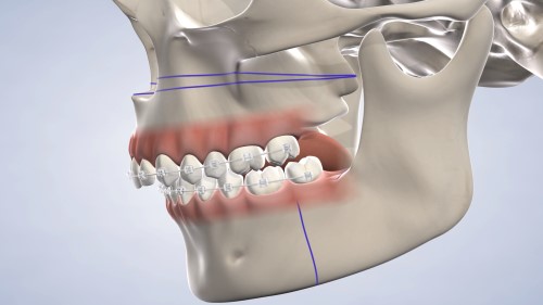 مقدمة كاملة لجراحة الفك والأسنان مع تطبيقها