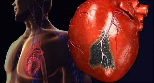 مقدمة كاملة عن جراحة زراعة القلب وأهميتها