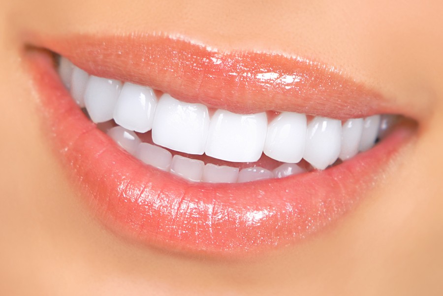 مقدمة كاملة عن صفائح الأسنان وفوائدها