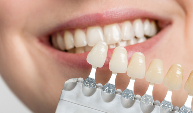 مقدمة كاملة عن مركب الأسنان وفوائده