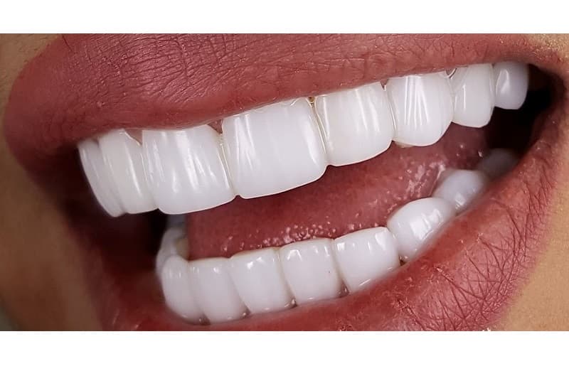 مقدمة كاملة عن مركب الأسنان وفوائده