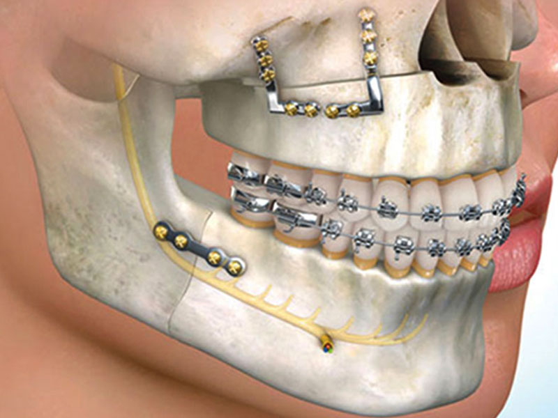 مقدمة كاملة لجراحة الفك والأسنان مع تطبيقها